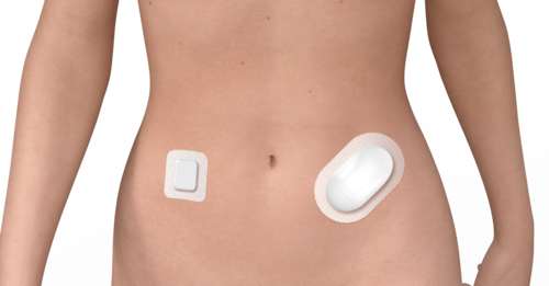 Wearables _ Insulinpumpe auf den Bauch geklebt.png